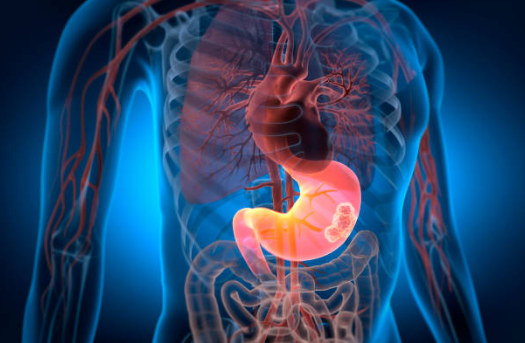 헬리코박터균의 원인과 증상, 진단, 치료와 예방 방법