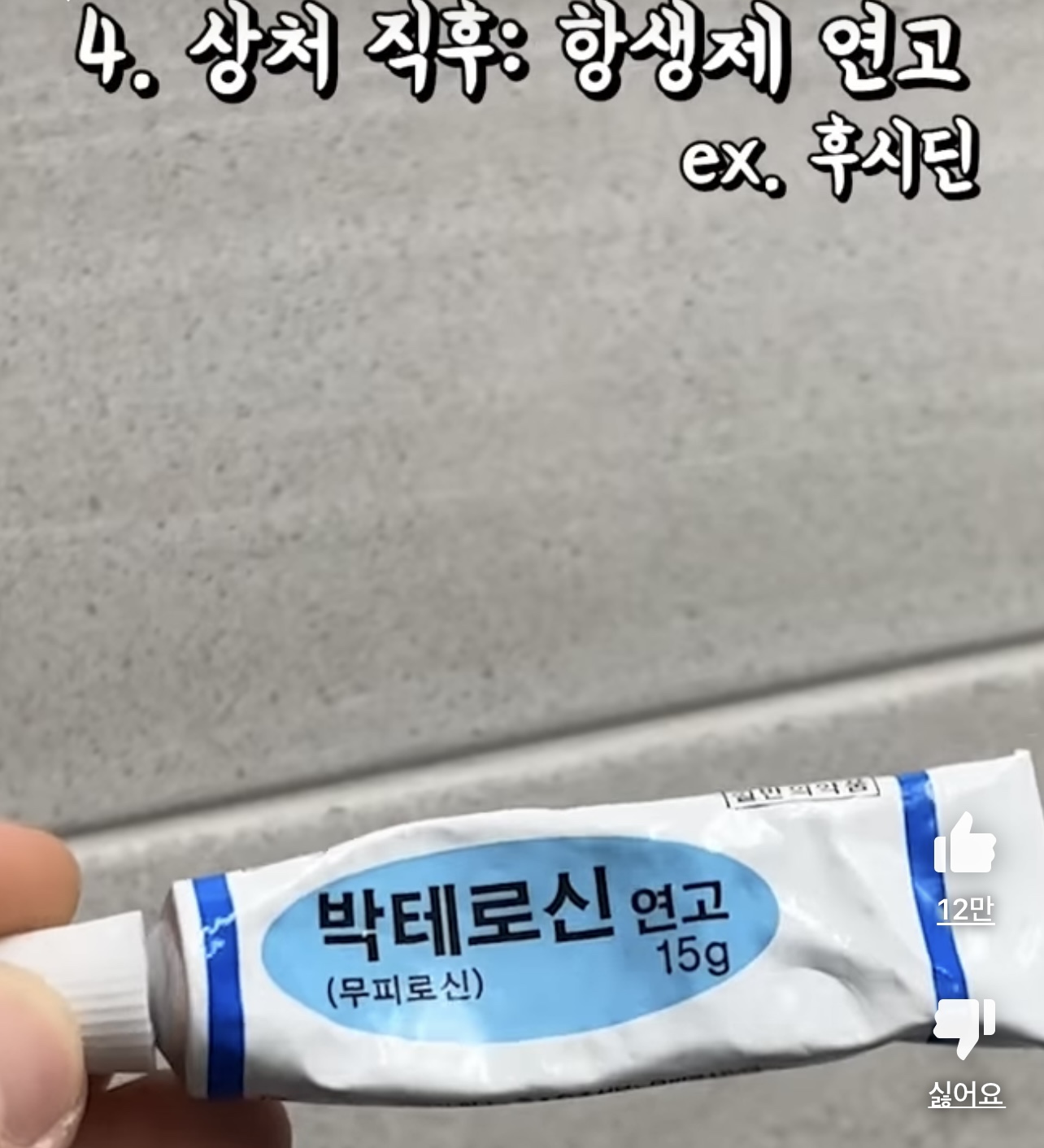 흉터 없이 여드름 짜는 방법