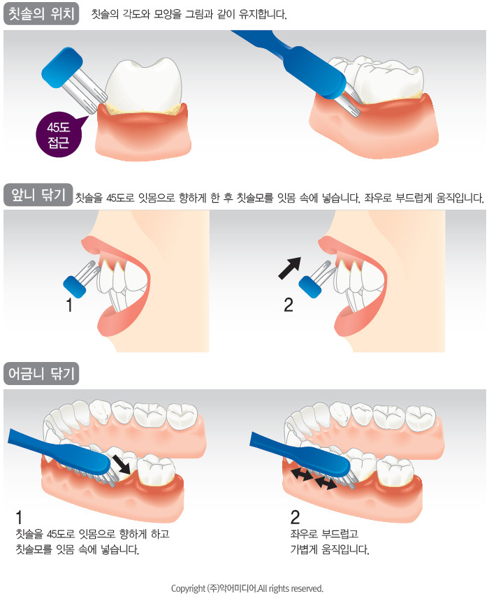 ▲ 붓고 피나는 잇몸 질환 극복하기 (이미지 : (주)악어미디어)