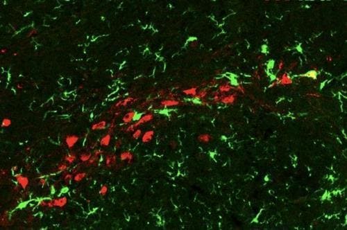 노년기 규칙적 운동이 인지 기능 저하를 막는 메커니즘 Exercise Alters Brain Chemistry to Protect Aging Synapses