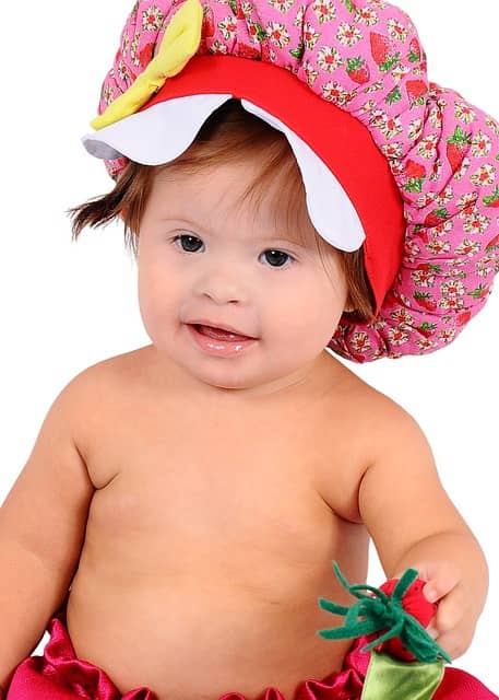 다운증후군 수명 지능 평균적인 특징