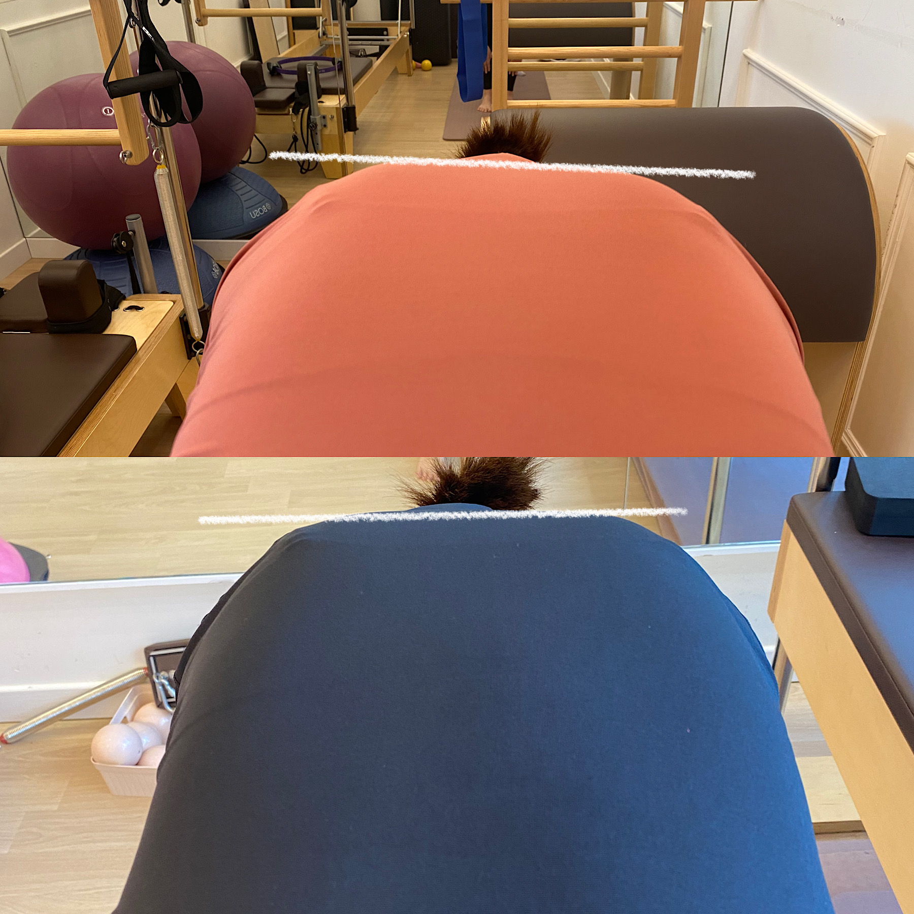 허리 아픈데 병원만 다녀야 하나요?