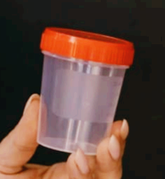 소변에 거품이 나는 이유