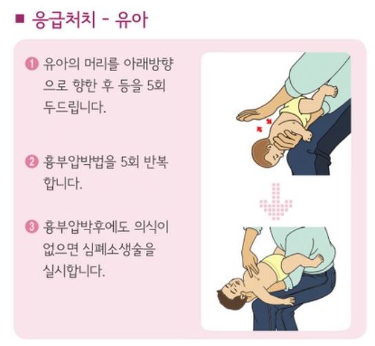 영아 하임리히법