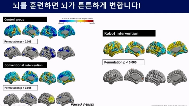 중년의뇌를갖는방법-슈퍼에이저