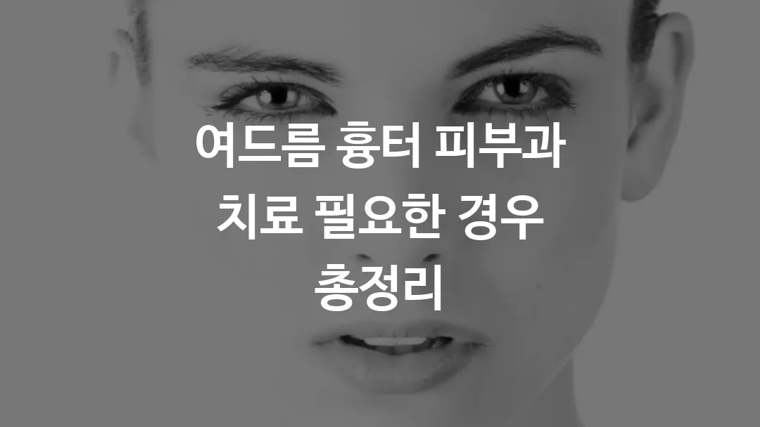 여드름 흉터 피부과 치료 필요한 경우 총정리