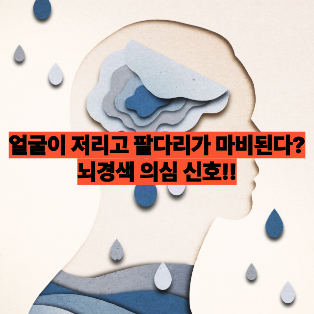 얼굴이 저리고 팔다리가 마비된다면? 뇌경색 의심 신호