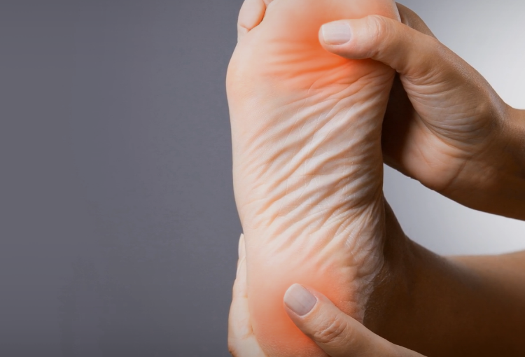 족저 근막염 자가치료