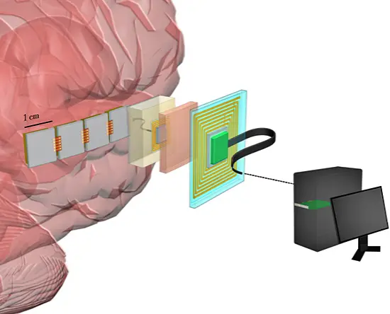 DARPA에서 투자한 패라드로믹스의 뇌 임플란트 기술 개념도