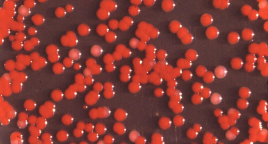 Serratia marcescens