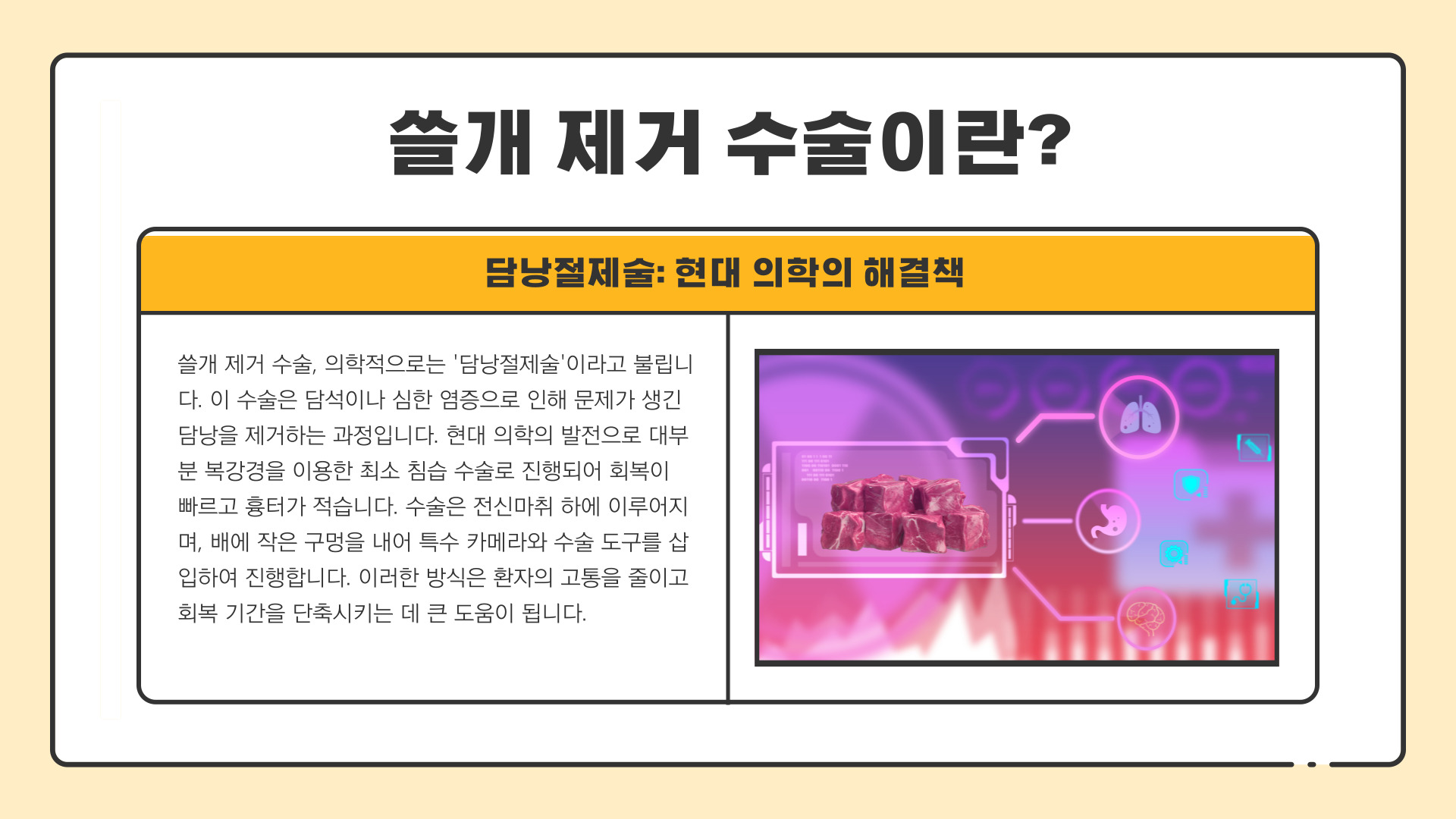 쓸개 제거 수술