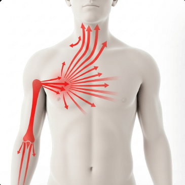 심근경색 초기증상 총정리5