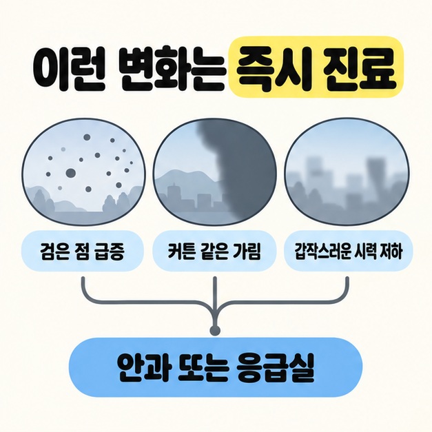 검은 점 급증과 커튼 같은 가림 및 갑작스러운 시력 저하의 시야 예시를 안과 또는 응급실 안내로 연결한 도식