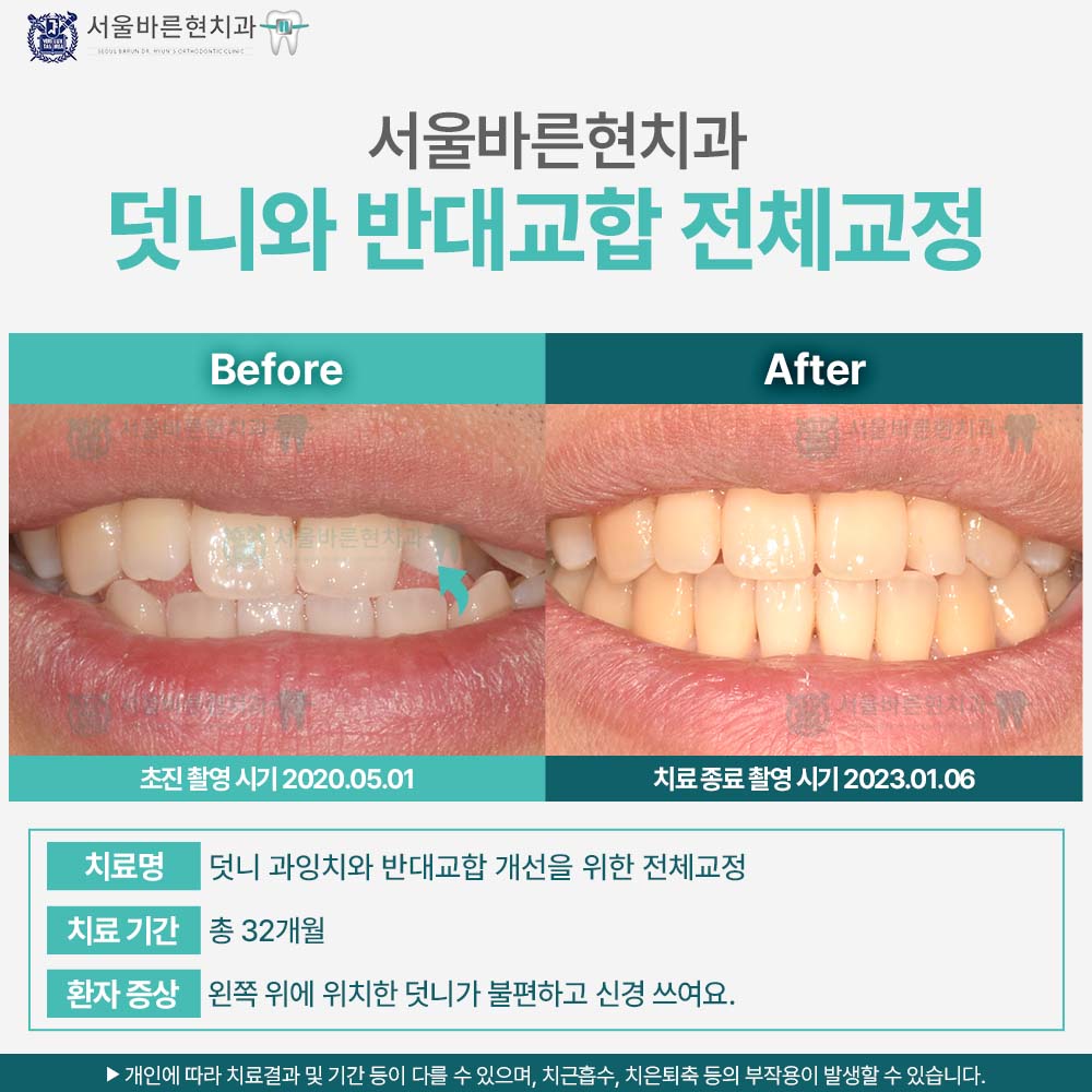 해운대교정치과