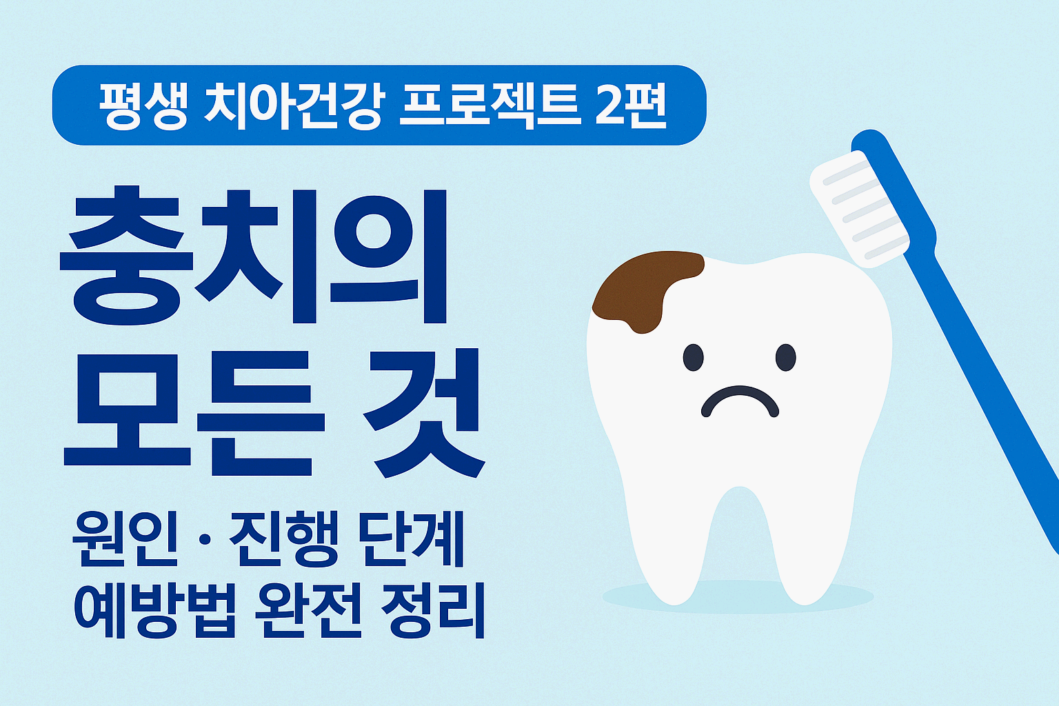 평생 치아건강 프로젝트 2편 - 충치의 모든 것(원인&middot;진행 단계&middot;예방법 완전 정리)