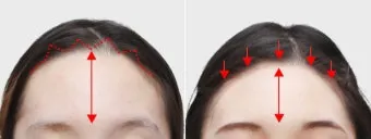 이마가 넓은 여자 관상 특징과 해석_46