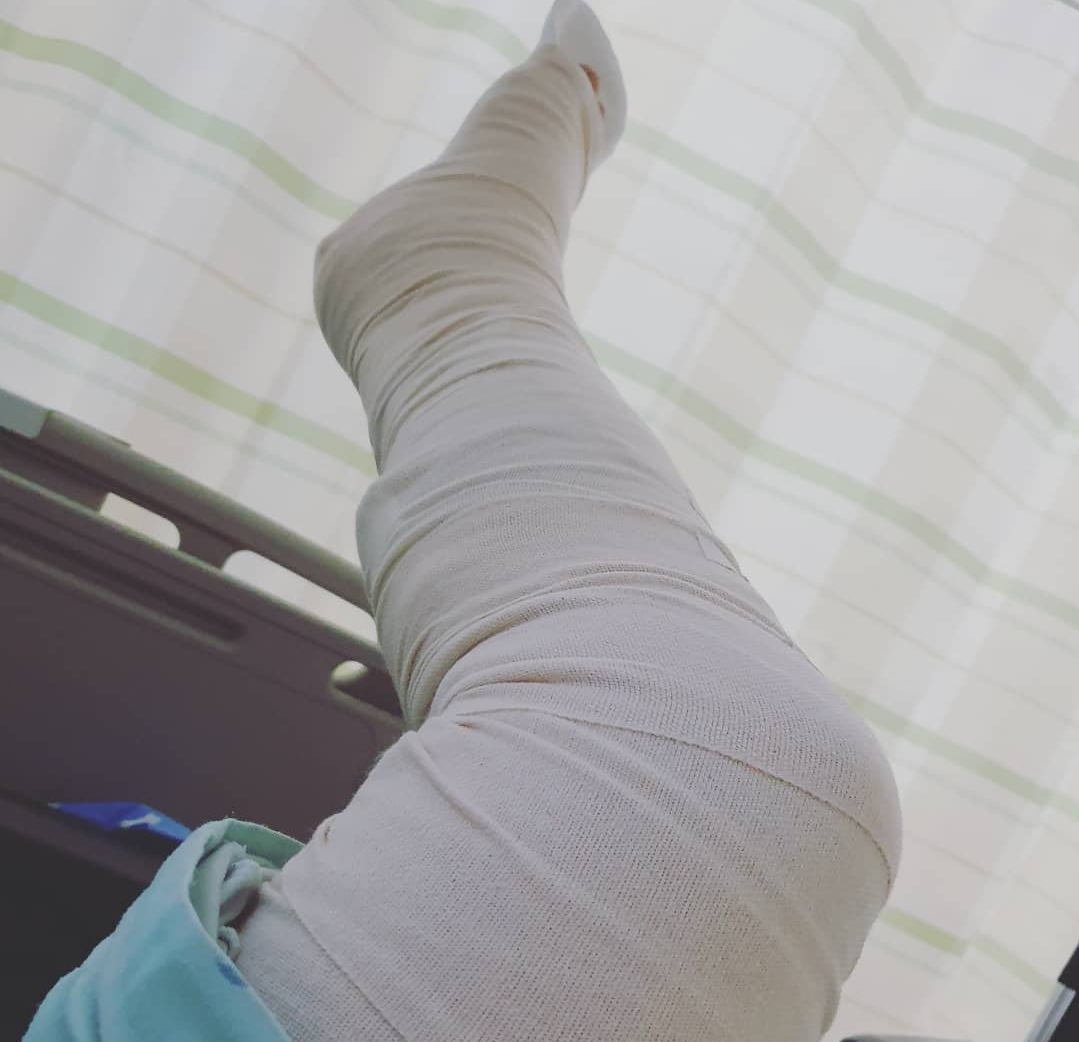 아킬레스건 파열 수술