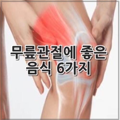 무릎관절에 좋은 음식 6가지