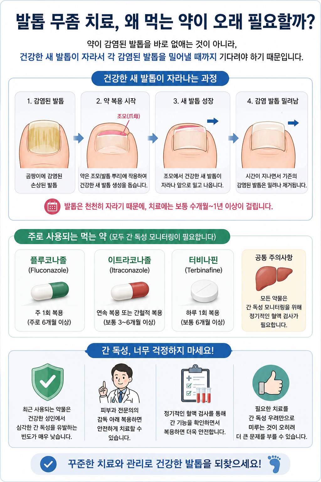 발톱 무좀 약물치료 정리