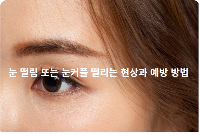 눈 떨림 또는 눈커플 떨리는 현상과 예방 방법