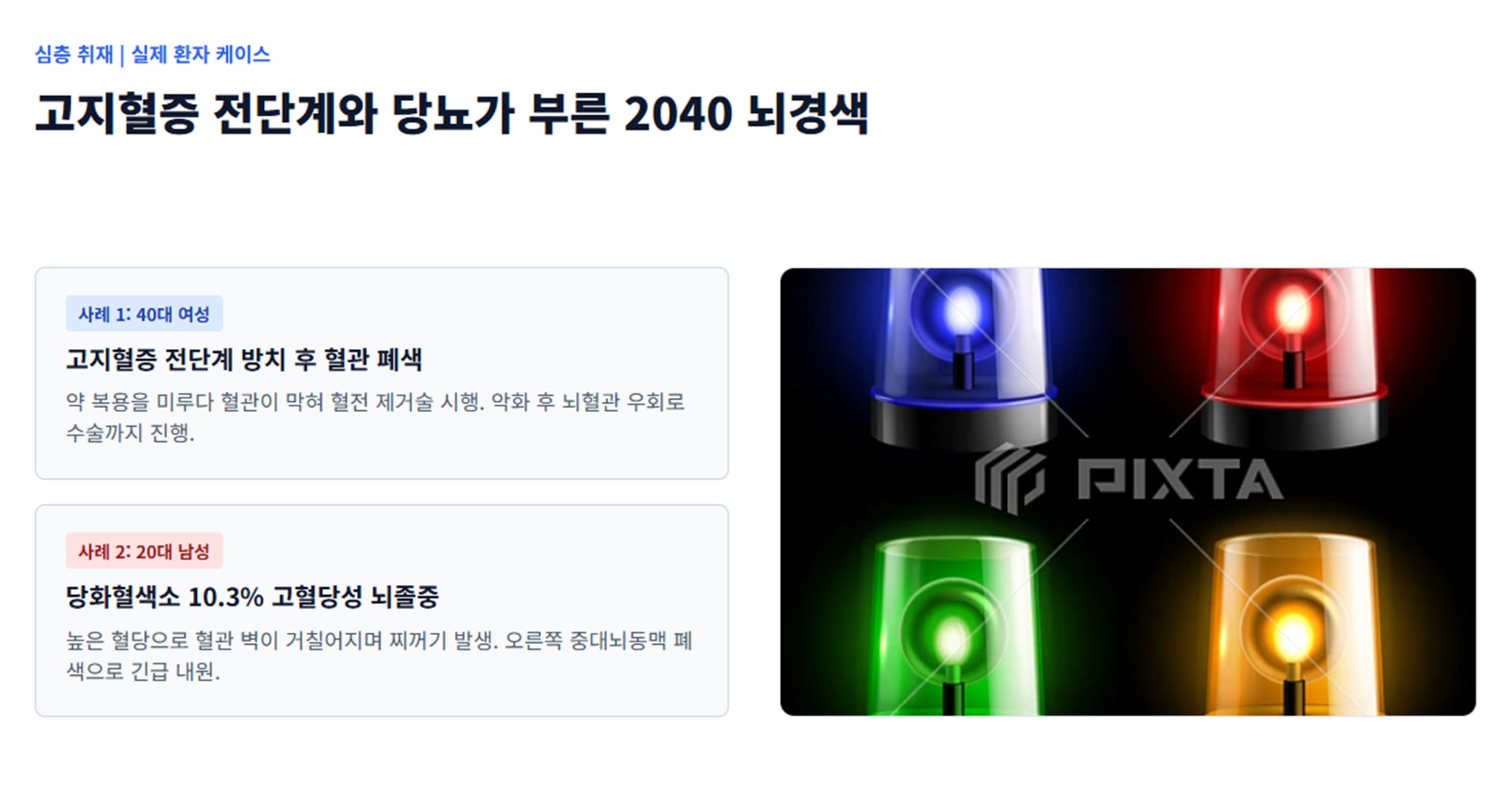 박익성-교수-젊어지는-뇌졸중