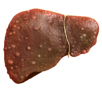 간 건강지표인 AST, GGT, ALT