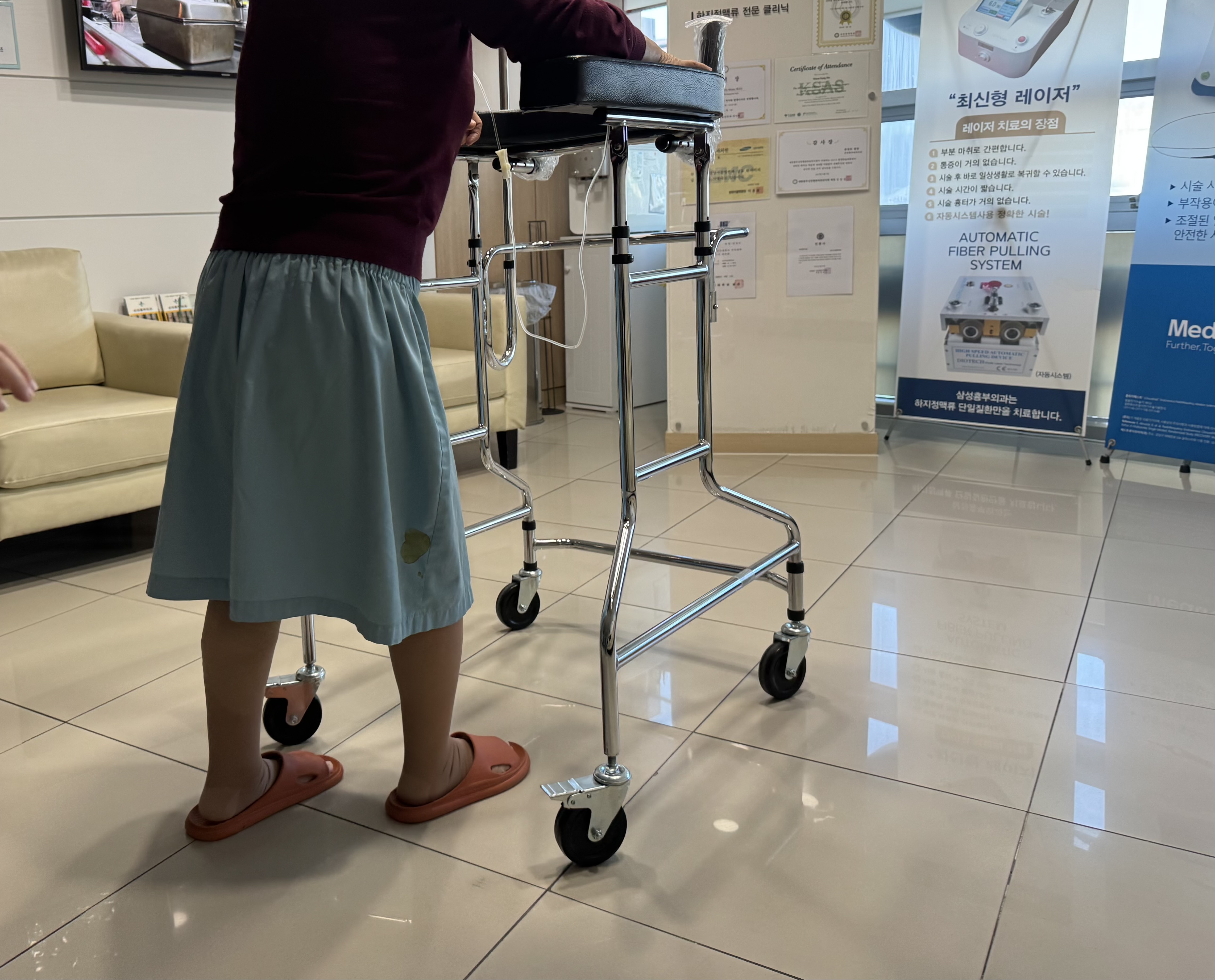 하지정맥류 수술 후기와 증상&middot;치료까지 한 번에 정리