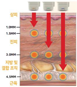 울세라 써머지