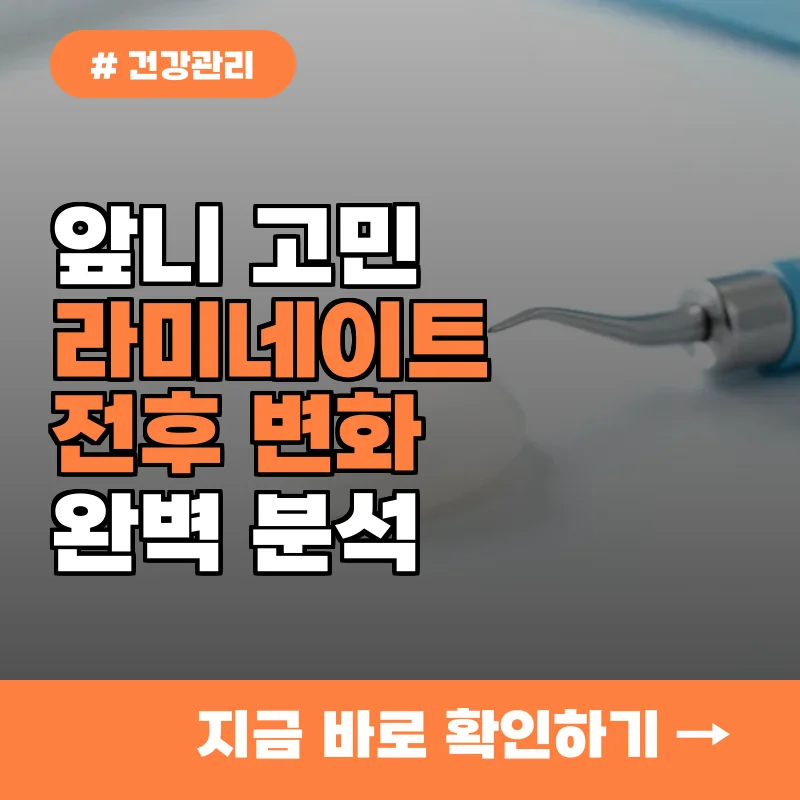 앞니 자신감 찾았어요&hellip; 라미네이트 시술 전후 변화는