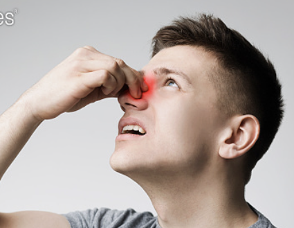 코피가 자주나는 이유 24