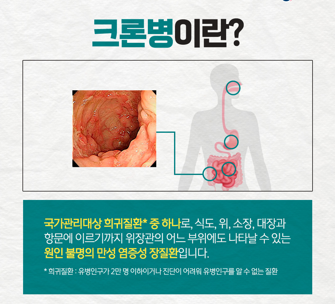 크로병이란 무엇인가?