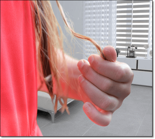 발모벽이 있는 여성