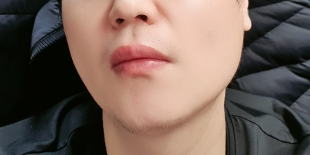 깨끗한-얼굴-피부