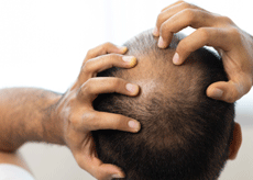 아보다트 가격&amp;#44; 부작용&amp;#44; 효과&amp;#44; 탈모약 비대면 처방