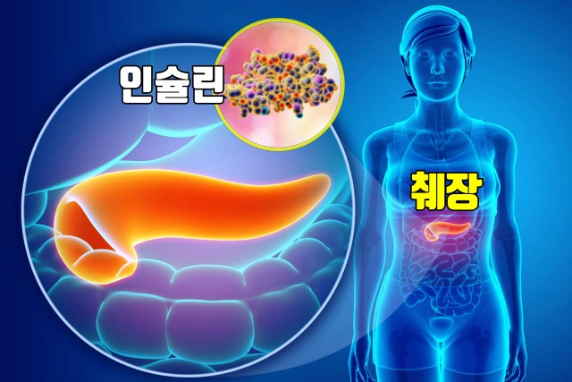 양파 껍질 효능, 당뇨 합병증 백내장, 양파 껍질차 효능, 양파 껍질 끓인물 효능, 건강 팁줌 매일꿀정보