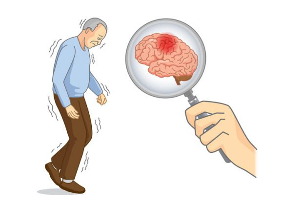 산정특례 대상질병코드
