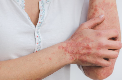 슈다페드정 주의 사항