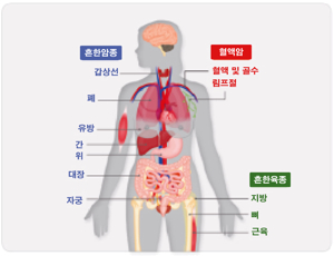 암