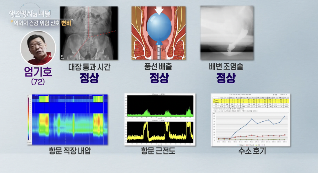 생로병사의 비밀, 변비, 몸이 보내는 위험신호