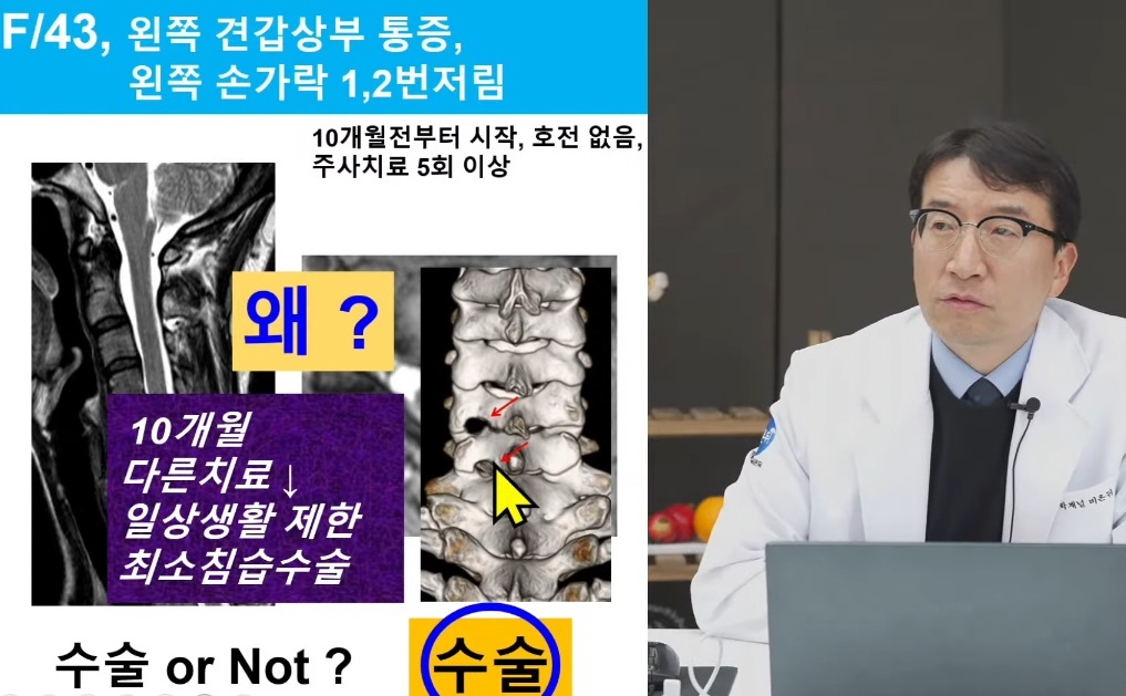 목중풍-강경중-교수-진료-예약