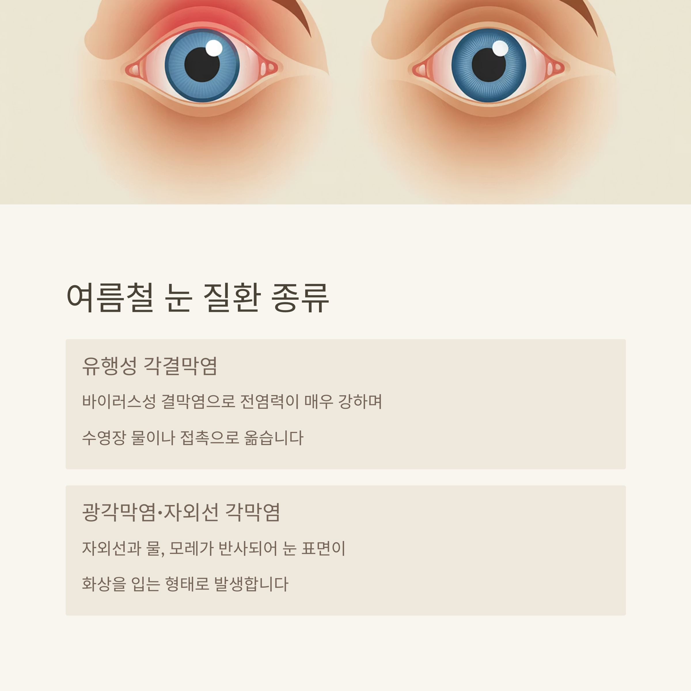 여름철 눈 질환 종류