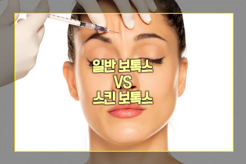 보톡스 스킨보톡스 차이점