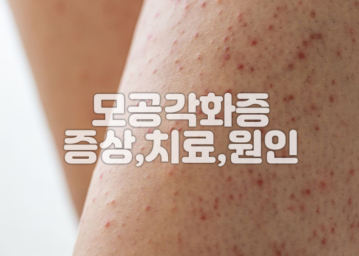 다리에 모공각화증이 발생해 있는 이미지