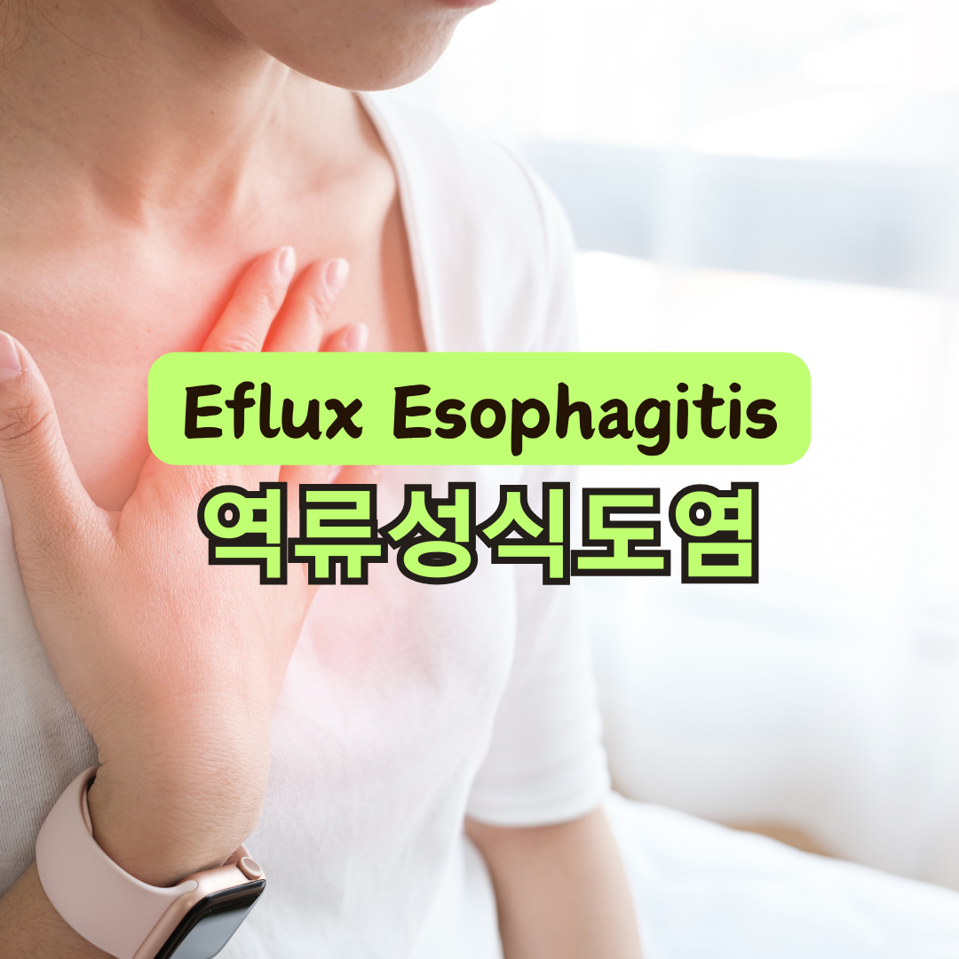 역류성 식도염에 좋은 음식 7가지와 영양제 성분 추천