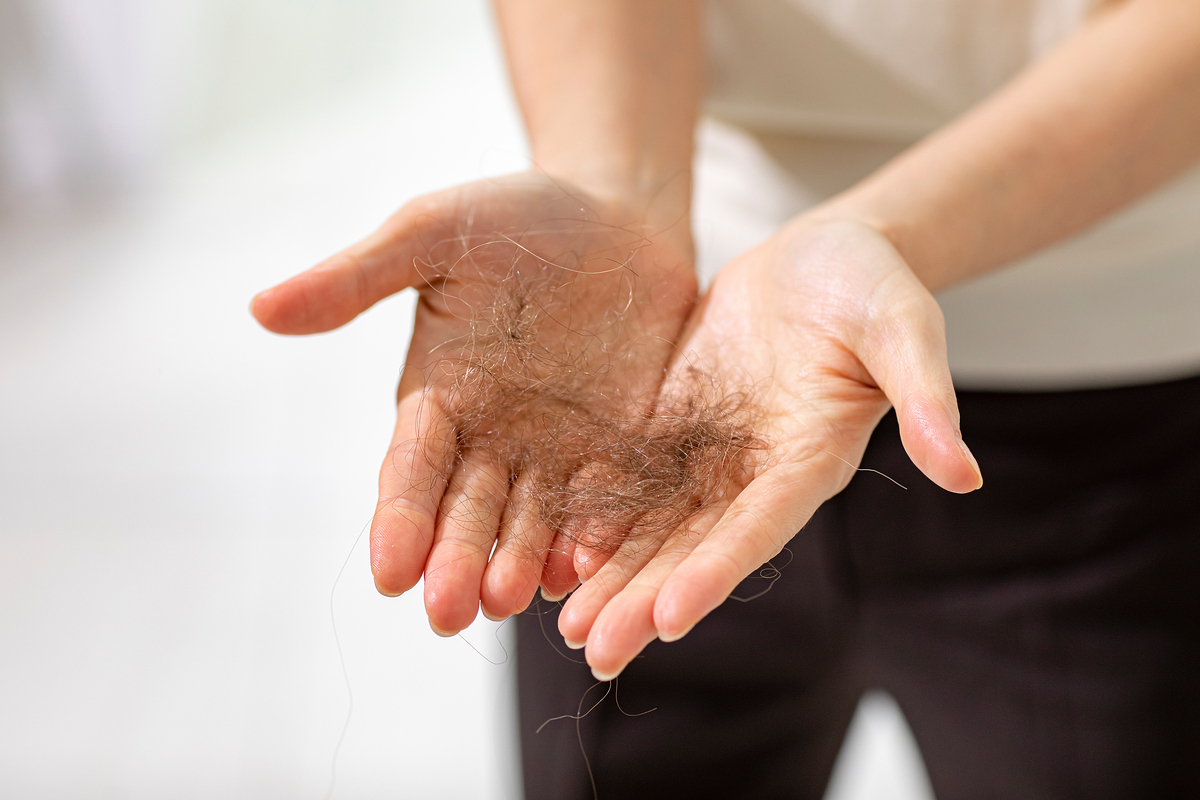 머리카락 빠진 사진