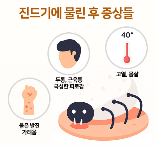 진드기 물린후 증상 물린 자국