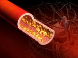 총콜레스테롤 정상수치