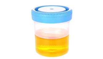 소변 색깔이 노란색