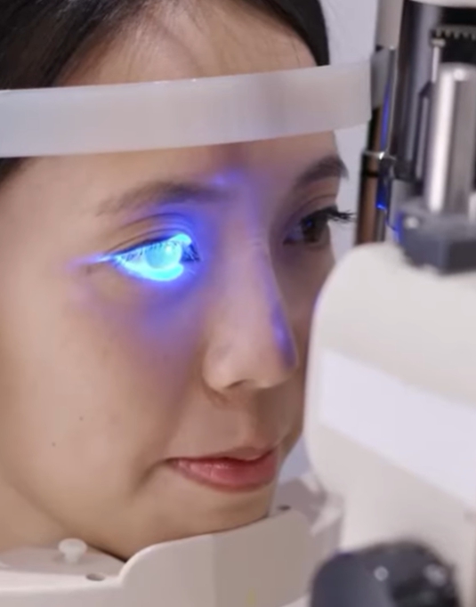 녹내장 초기증상