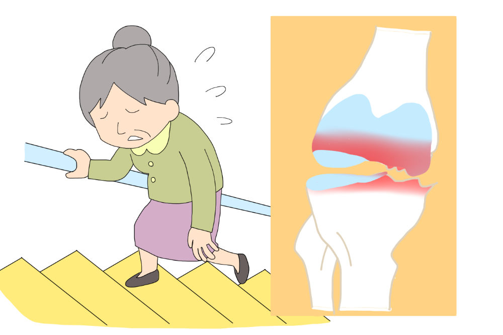 뼈와 관절 건강 개선2
